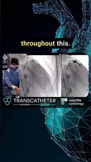 Dr Widmer's Cath Lab Guide to Coronary Reactivity Testing in Non‑Obstructive CAD