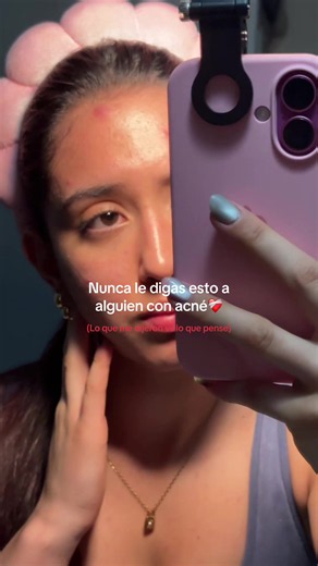 Junio es el mes del acné y no solo significa tener granitos, constantemente recibes comentarios sobre tu apariencia que muchas veces pueden ser hirientes. Por eso, muchas personas terminan aislándose, con problemas de autoestima e incluso pueden desarrollar ansiedad o depresión. Hay que ser más empaticos y conscientes para no hacer sentir juzgadas a personas por la apariencia de su piel❤️‍🩹 #acné #granitosenelcuerpo #acnejourney #pielperfecta #acneadulto
