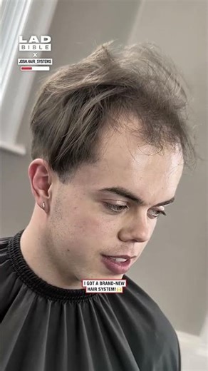 This is how I fixed my hairline 😲⁠ (🎥: IG/ josh.hair_systems)