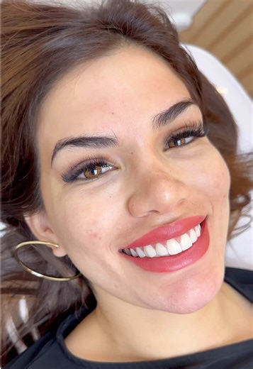 Micropigmentación de Labios: Color y Confianza Todo el Día