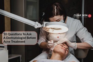 Questions to Ask Your Dermatologist Before Starting Acne Treatment | Clear Skin