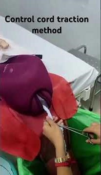 Control cord traction #training #midwifery #medical #profession #sgtuniversity #trending #shorts