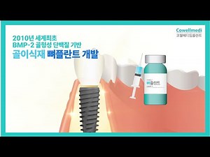 [임플란트 필수] 골형성 유도 단백질로 완벽한 잇몸뼈를! 코웰메디 뼈플란트