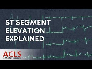 ST Segment Elevation Explained | ACLS Certification Association