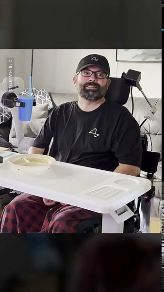 Neuralink patient controls robot arm using only his hand movements