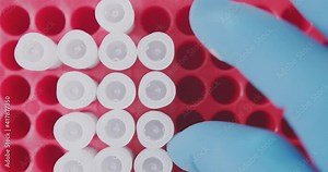 Lab technician loads the samples together with the sample into the lab stand Stock Video