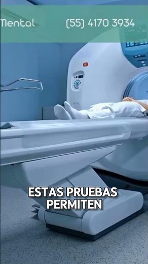 Diagnóstico de la atrofia cerebral ¿Cómo las imágenes médicas revelan el daño cerebral? #sabiasque