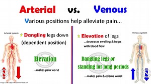 Peripheral Arterial Disease vs. Peripheral Venous Disease NCLEX Review