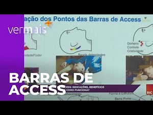 Barras de Access: indicações, benefícios e como funciona?