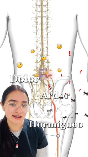 Clínica de Fisioterapia on Instagram: "¿Dolor que baja de la espalda a la pierna? Podría ser el nervio ciático. El ciático es el nervio más largo del cuerpo y cuando se irrita puede causar: ✔️ Dolor ✔️ Ardor ✔️ Hormigueo ✔️ Sensación de corriente en la pierna La buena noticia es que con fisioterapia se puede mejorar 🙌 Trabajamos la causa del dolor, no solo el síntoma, para que puedas moverte sin miedo y sin molestias. 📍 Si estás pasando por esto, no lo ignores. En la clínica te acompaño con un