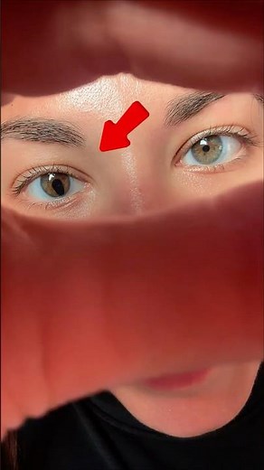 Cat Eyes on Humans!? What Causes It