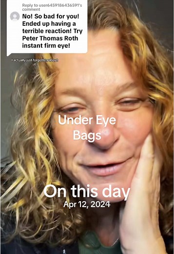 Get Rid of Under Eye Bags with Preparation H