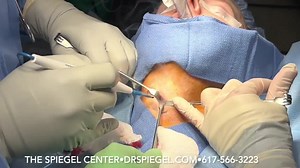 Trachea Shave Operation