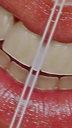 Get some pearly white teeth. #fyp #foryou #selfimprovement #health #teeth #whiteteeth #aestheticprimal #theskyscrapermethod #skyscrapermethod #aesthetics