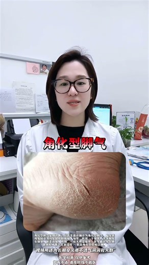 Why You Should Never Wear Crocs: A Doctor's Shocking Revelation