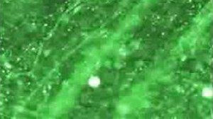 Pacemaker cells explained