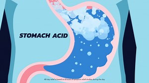 Pepcid Complete Acid Reducer + Antacid for Acid Reflux, 10mg Famotidine, 800mg Calcium Carbonate & 165mg Magnesium Hydroxide per Heartburn Tablet, Antacid Chews, Tropical Fruit, 50 ct