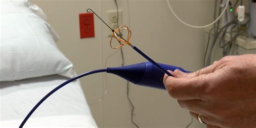 Local doctor discusses new treatment option for AFib