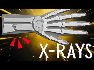 Why and how do we use X-rays in medicine