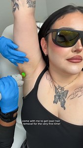 7.8M views · 6.4K reactions | MY LASER HAIR REMOVAL EXPERIENCE  @milanlaser :: #laserhairremoval #pcos #hairremoval #beauty | Onigiri.Nana | Facebook