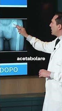 Total hip replacement: anatomical reconstruction and early functional recovery