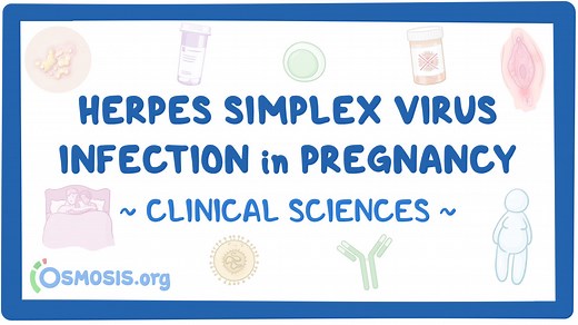 Herpes simplex virus infection in pregnancy: Video & Meaning | Osmosis
