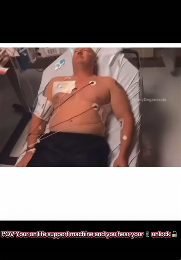 When your on life support machine and someone unlocks your phone 🤣#lifesupportmachine#phone