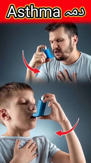 7K views · 262 reactions | Asthma is a long-term inflammatory Disease Causes, Risk Factors, Investigation and Treatment in Pashto by Dr Mustaqeem Medical information And Awareness Videos دمہ کی بیماری وجوہات اور بچاؤ کے ساتھ علاج #asthma #asthmadisease #asthmacauses #asthmariskfactors #asthmainvestigation #asthmatreatment #drmustaqeem #pashto #medical #information #awarnessvideo | Dr. Mustaqeem | Facebook