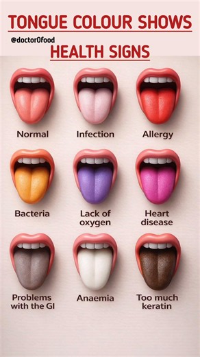 Tongue Color Reveals Hidden Health Signs | What Your Tongue Says About Your Health #healthylifestyle