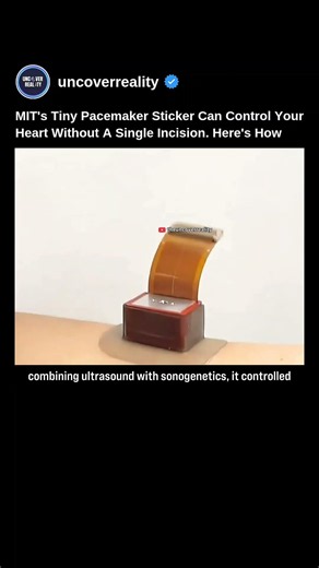 MIT's Tiny Pacemaker Sticker Can Control Your Heart Without A Single Incision #medical #shorts