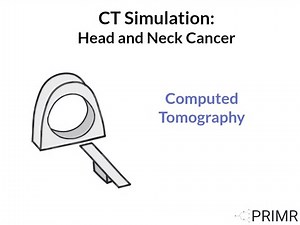Doctor Explains CT Simulation for Head and Neck Cancer