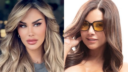 Aleida Núñez preocupada por Ninel Conde tras su cirugía para cambiar el color de sus ojos: “Valoro mi vida”