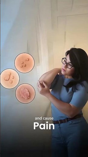 Papilloma is a benign non cancerous growth that can appear in different parts of the body.