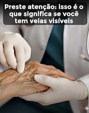 Preste muita atenção, porque isso é o que realmente significa ter veias visíveis e saltadas