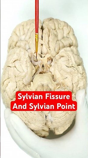 Sylvian fissure and Sylvian point