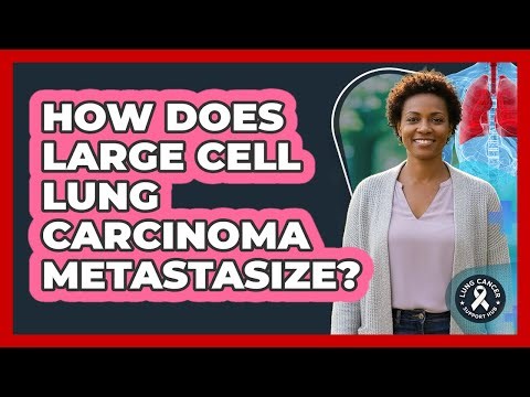 How Does Large Cell Lung Carcinoma Metastasize? - Lung Cancer Support Hub