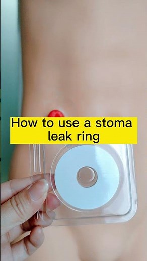 How to use a stoma leak ring