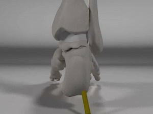 1.3K views · 33 reactions | Foot Pronation and Supination, View from...