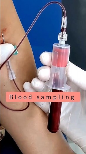 Blood sampling | blood