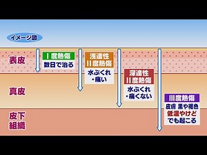 いわて元気○（マル） 【やけどに注意】（2020/12/8放送 ニュースプラス１いわて）
