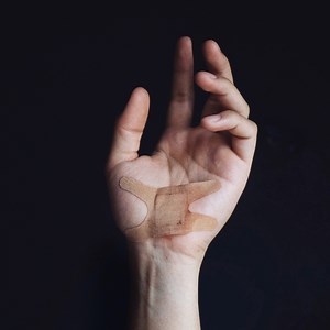 How to Tell If a Cut Should Get Stitches