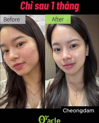 TikTok의 Viện Da Liễu Oracle Cheongdam