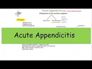 Acute Appendicitis - etiology, classification, clinical picture, diagnosis, and treatment