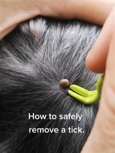 In this gripping moment, a veterinarian carefully inspects a tick lodged in a dog’s skin. Using steady hands, he starts with a tick twister, slowly rotating it until the parasite releases from the skin, helping prevent complications. When the tick slips free from the tool, the tension briefly spikes. The vet immediately switches to forceps, securing and removing the tick completely. The situation is handled smoothly, showing skill and quick judgment. The scene then shifts to relief, the dog is s