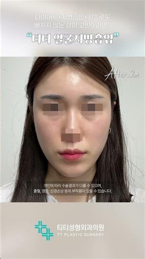 크게 바꾼 건 없는데 인상이 달라졌다면?🌈