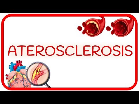 Atherosclerosis - causes, pathophysiology, and risk factors