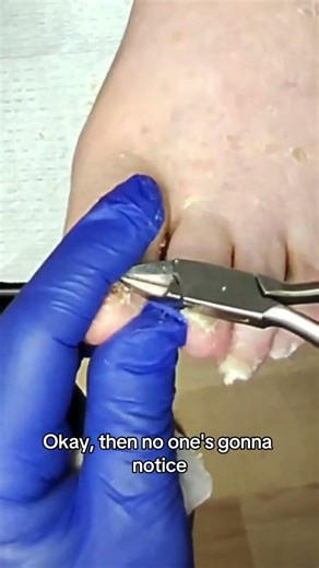 The Importance of Regular Skin Checks