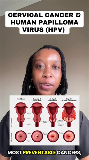 Cervical Cancer & HPV: What You Need to Know