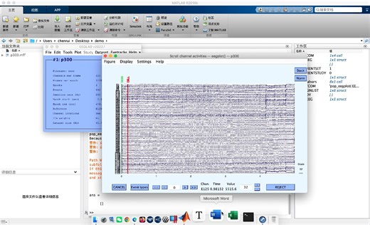 EEG技术教程：使用netstation修改EGI数据的mark
