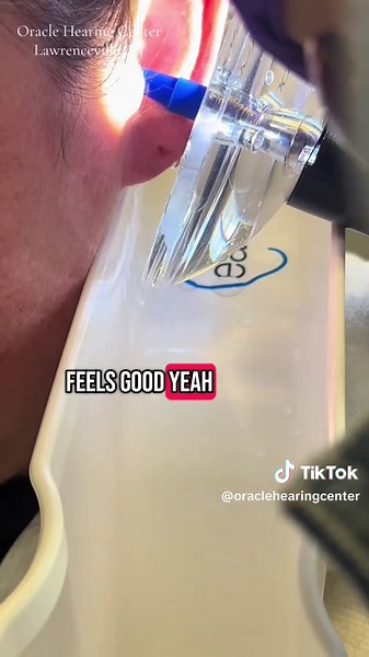 One of the fastest earwax removals to date. Backstory: she came to see us last week with old, hard earwax. After a few days of drops, the earwax plug was ready to evacuate. So glad we could help her. Like and follow for more ear shenanigans. Www.oraclehearingcenter.com #oraclehearingcenter #lawrencevillenj #earwaxremoval #earwaxextraction #earigator #hearingloss #audiologist #earwax #ears #drpimplepopper #hearingloss #satisfyingvideos #satisfying #eardrums